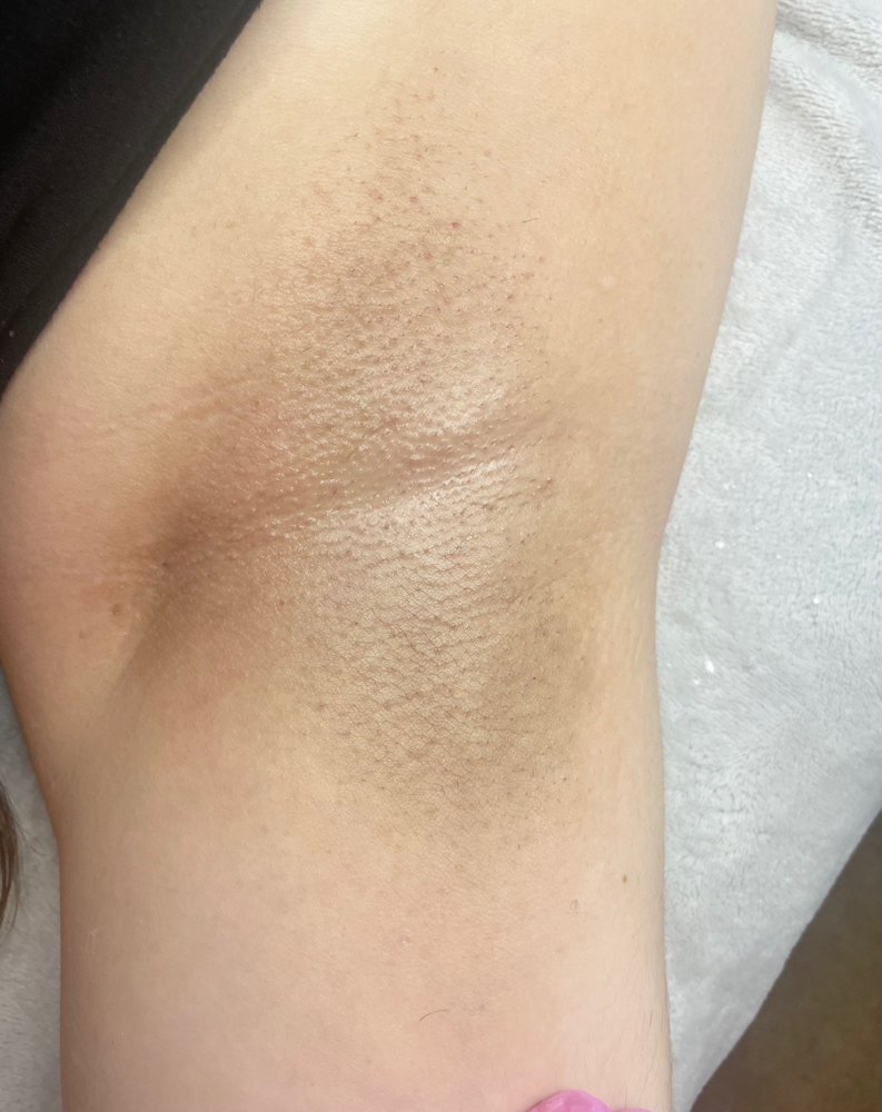 Underarm Wax