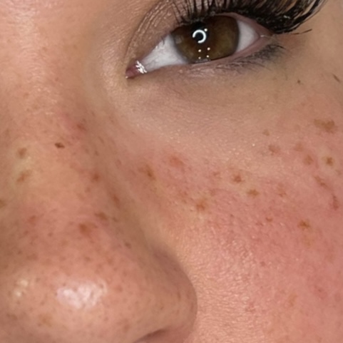 Freckle Tattoo at The Beauty Spot by Meredith in Freehold, NJ