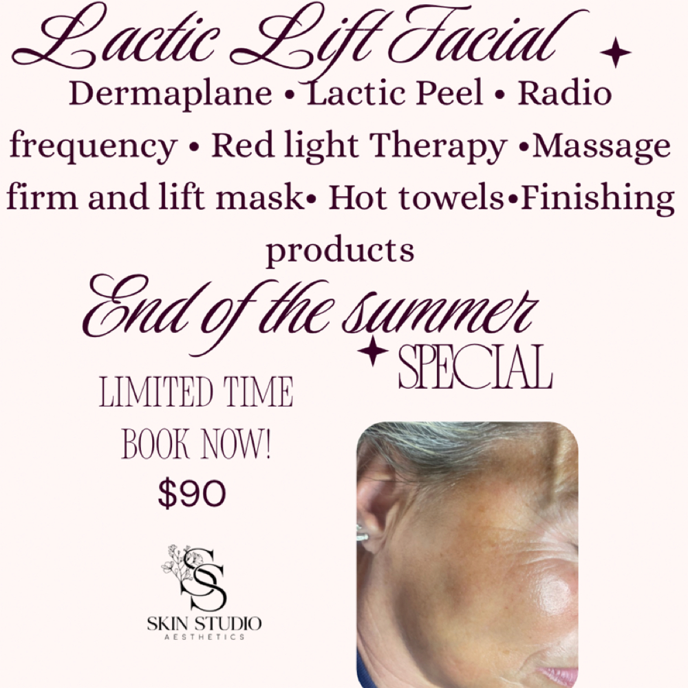 Lactic lift Facial at Skin Studio Aesthetics in Altoona, AL