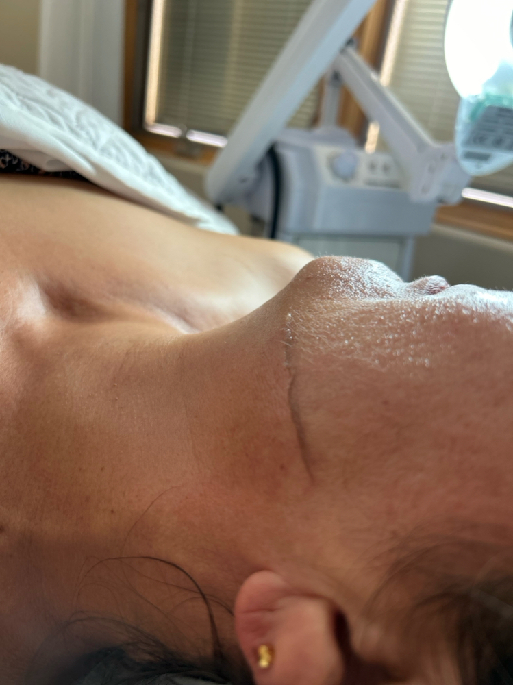 Dermaplane
