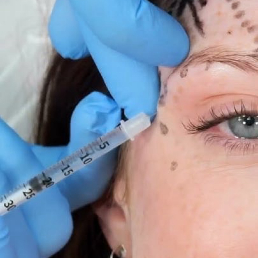 DAXXIFY- Brow Lift/Levantamiento at Lumé Aesthetics in Pharr, TX