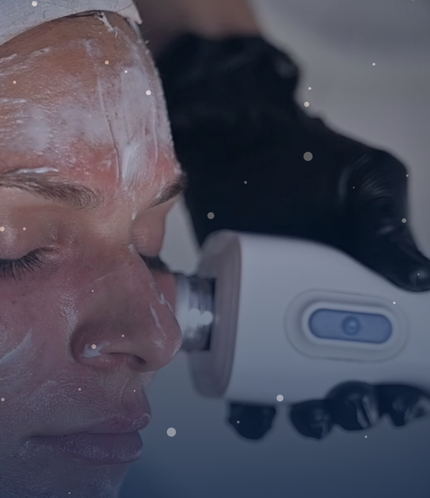 Upgraded Microderm with Glacial FX