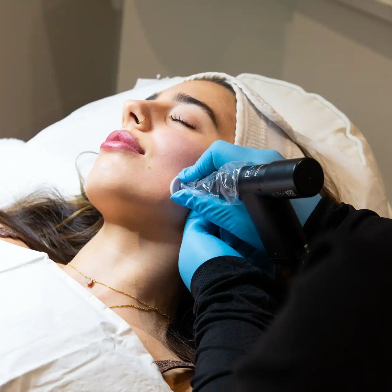Microchanneling Procell Therapies at Marbella Aesthetics Academy & Suites CO in Orlando, FL