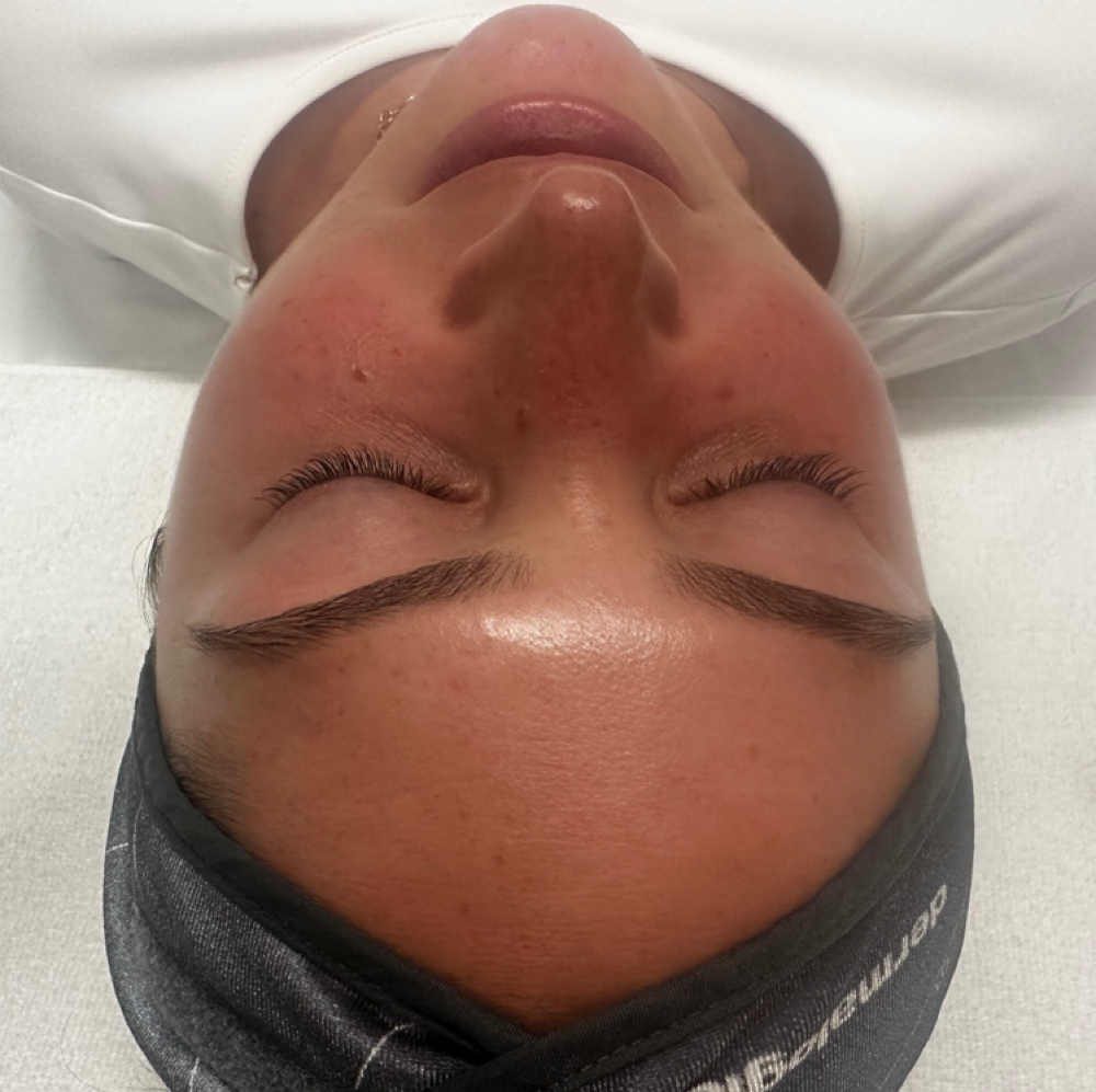 ULTIMATE GLOW FACIAL at A Glow By Laura in Philadelphia, PA