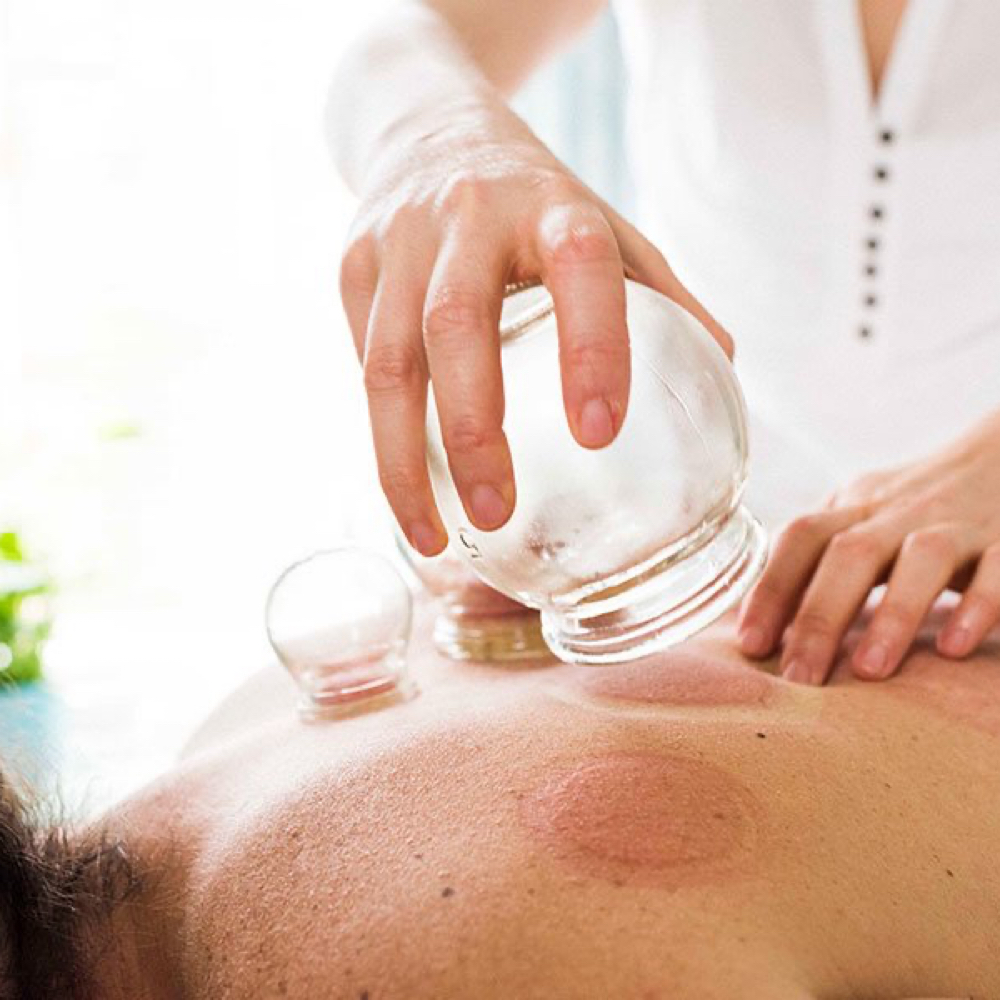 Cupping Massage at Unique Clinique Aesthetics in Brooklyn, NY