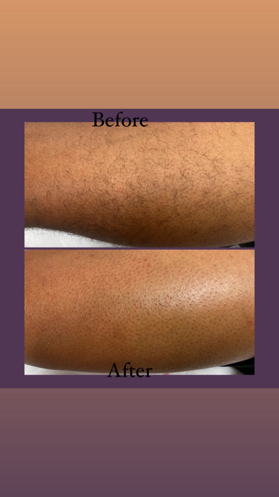 Leg Wax (half Leg)