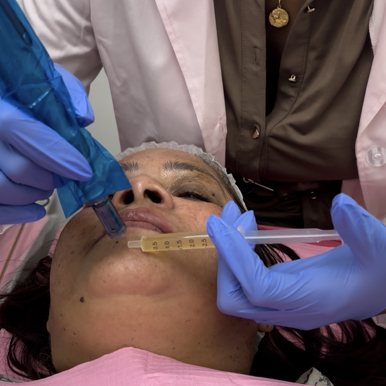 PRP Facial (Vampire) at Arewa Essential Medspa in Mamaroneck, NY