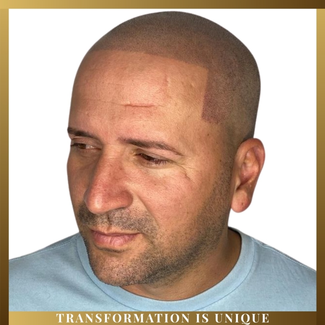 SMP Annual Maintenance (1 Year)