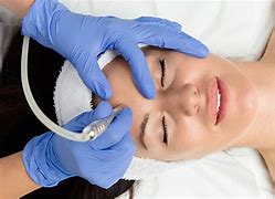 Microdermabrasion