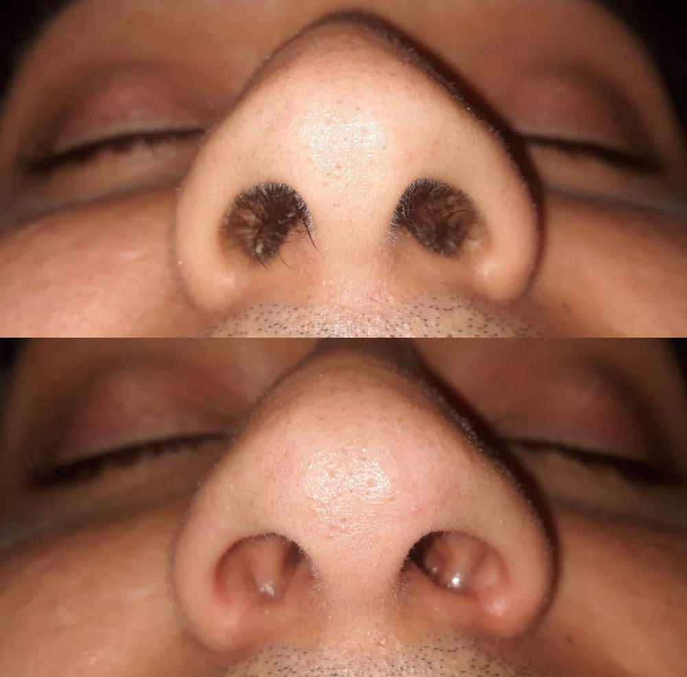 2 Area Face Wax