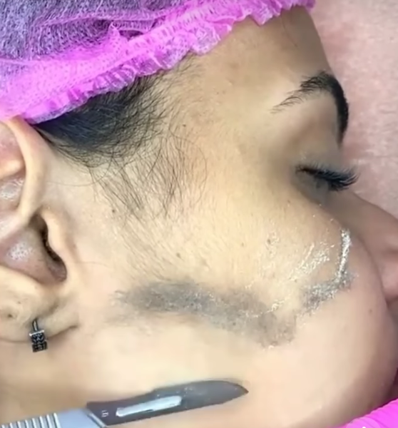 Dermaplaning Facial