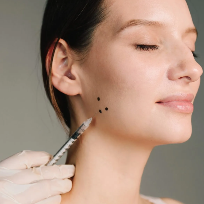 masseter tox at Chelsea Injects in Kingwood, TX
