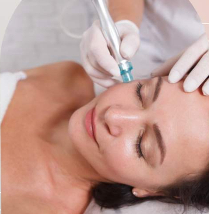 Add On -Dermabrasion