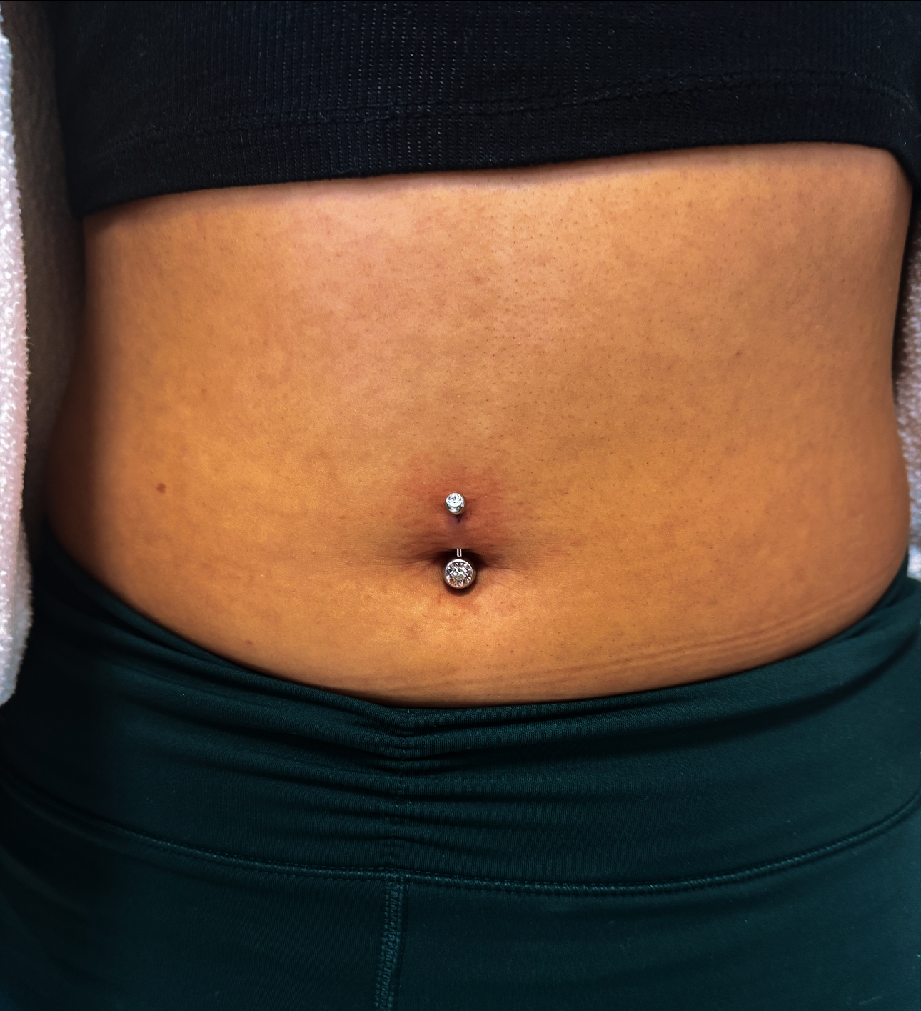 Belly