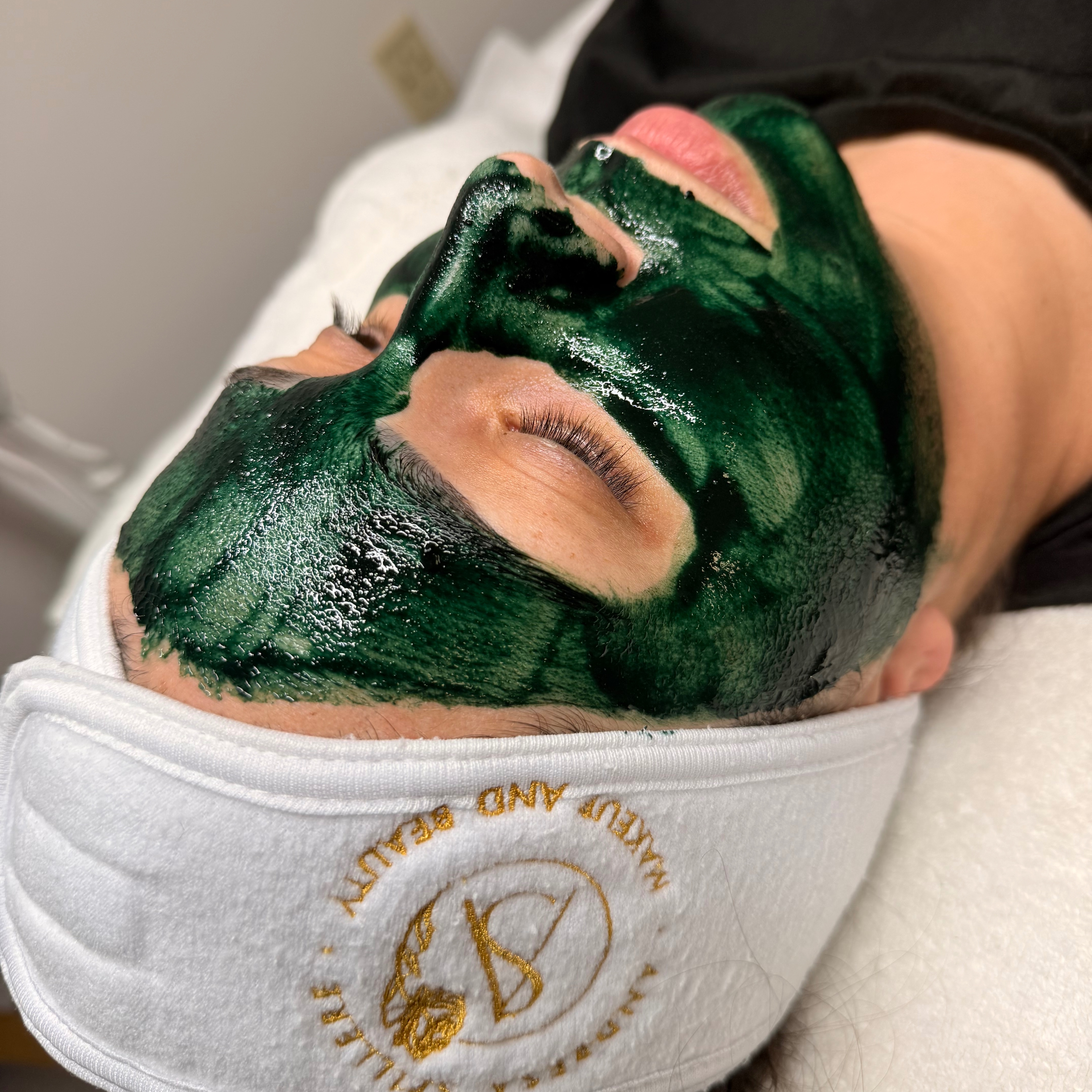 Peeling Clarifying Rosacea Melasma at Andresa  Spillere Makeup And Beauty in Stoneham, MA