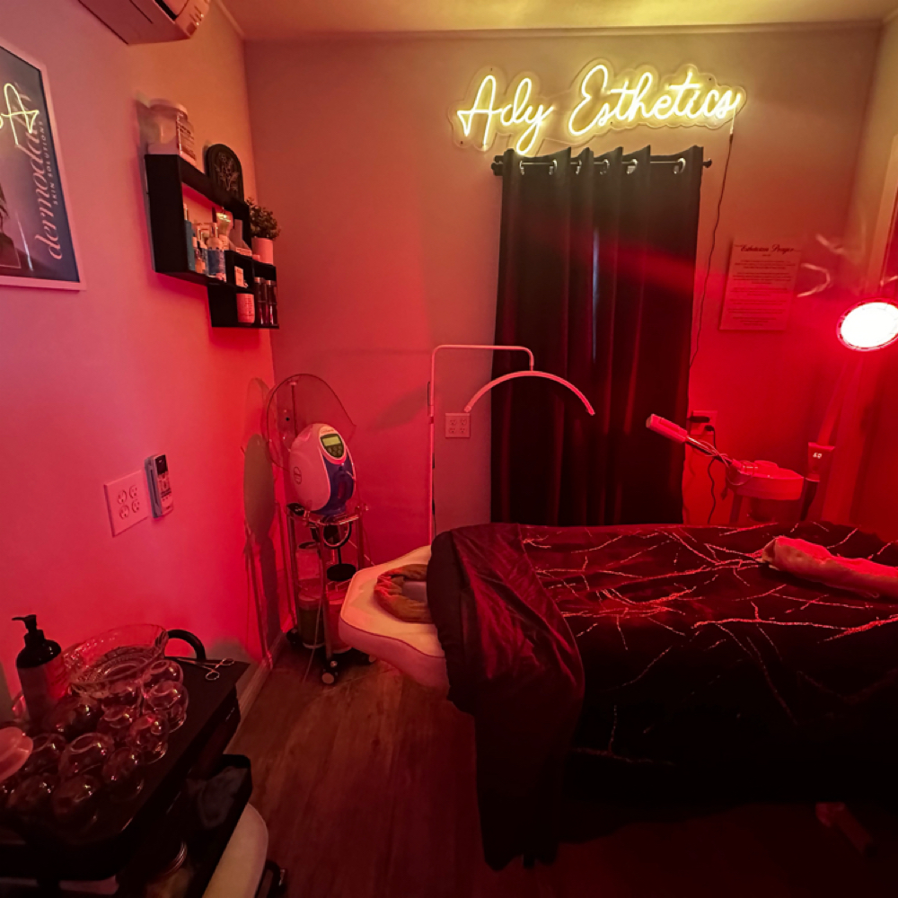 ✨The Ultimate Cupping Reset at Ady Esthetics in San Diego, CA