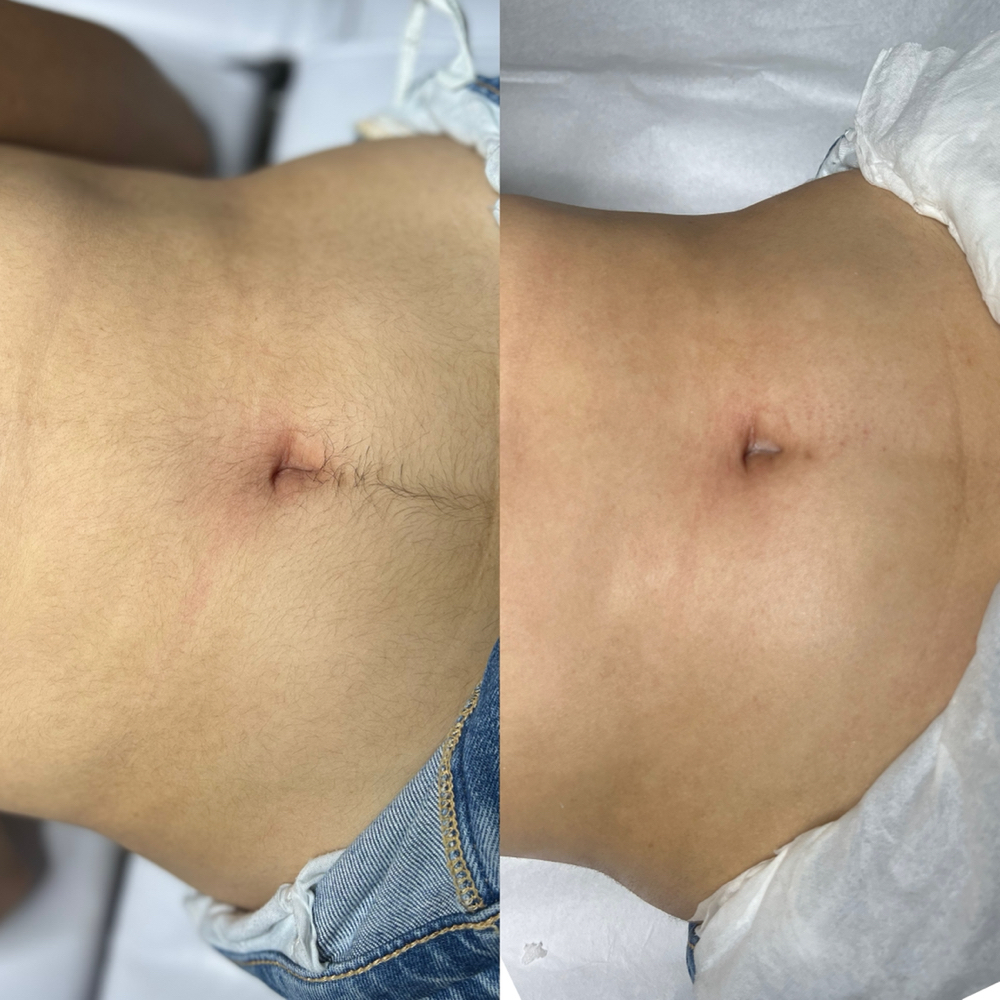 Stomach Wax