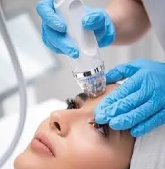 PRP RF Microneedling