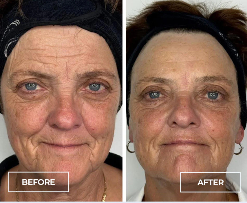 SWiCH ADVANCED TREATMENT