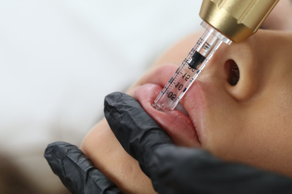 Hyaluronic Pen - 1 ML at MUAH in Austin, TX