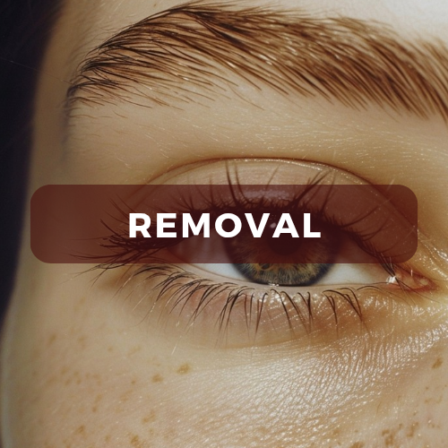 Lash Removal