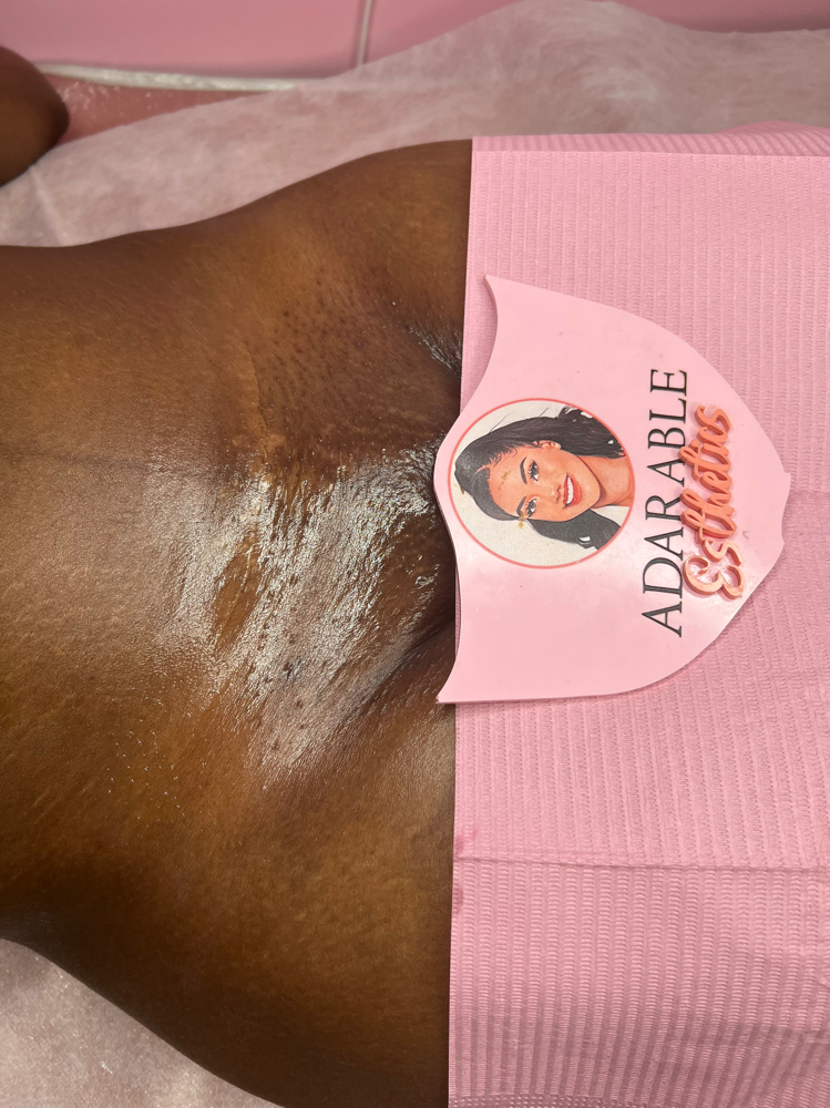 Bikini Wax at Adarable Esthetics LLC in Taunton, MA