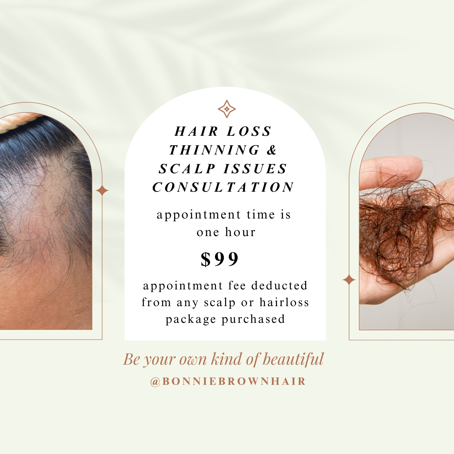 Hair Loss Consultation
