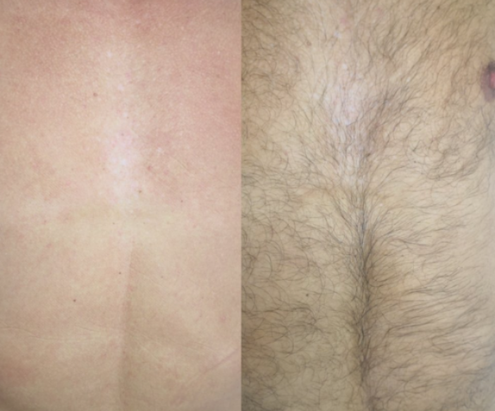 men’s chest wax