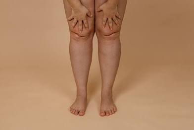 Knees & Lower Thighs