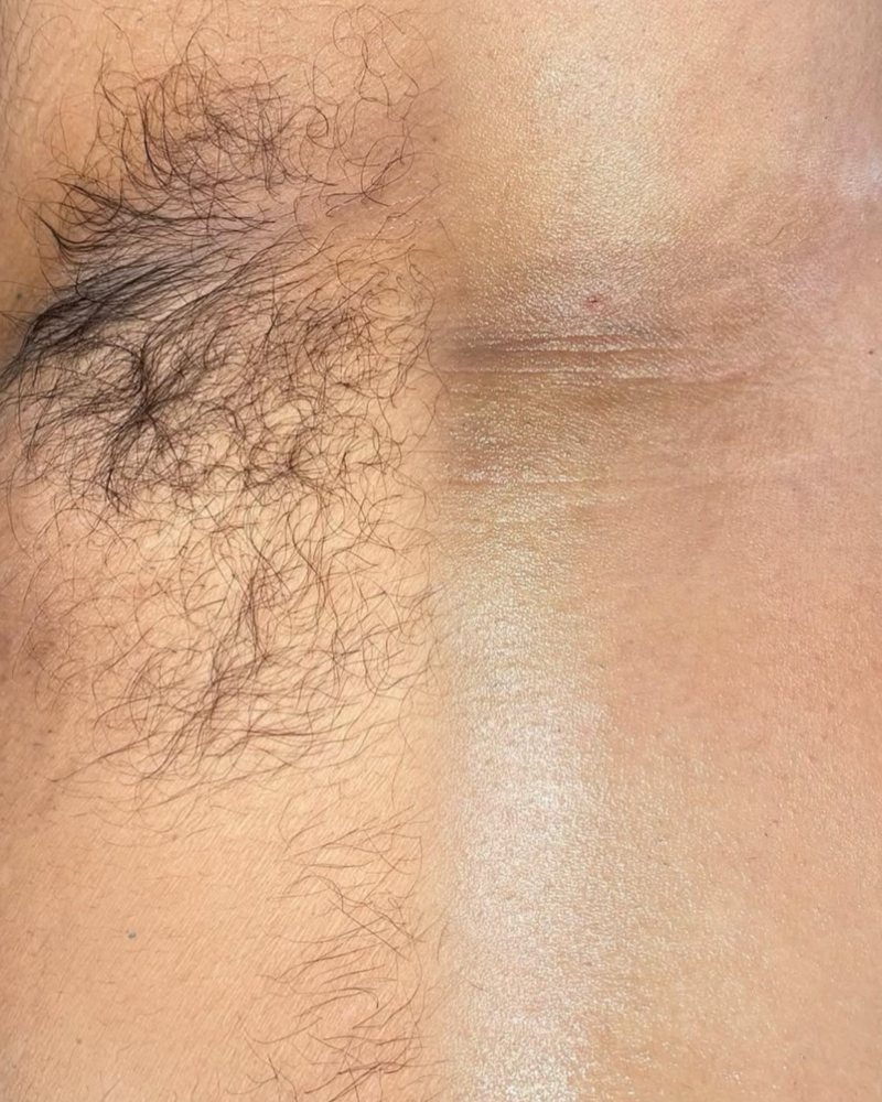 ZER0 = Underarm Hair [FOR HIM]™