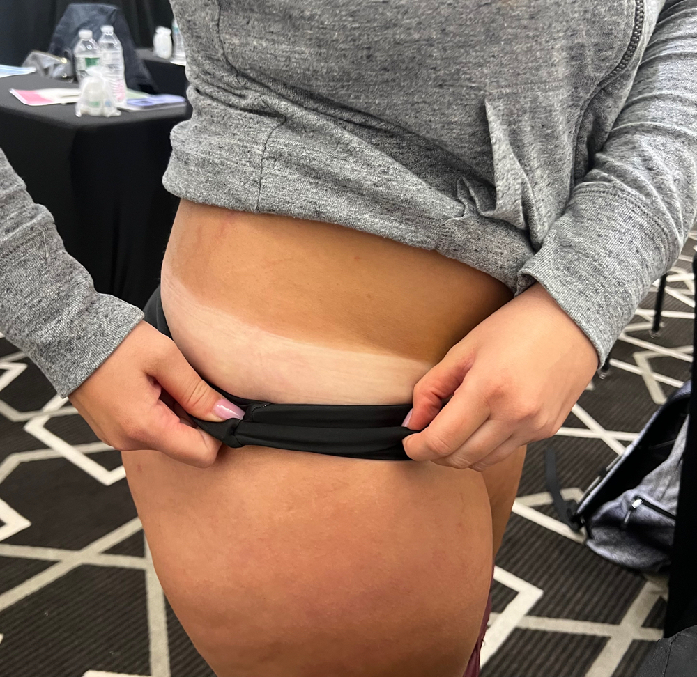 Rapid Spray Tan