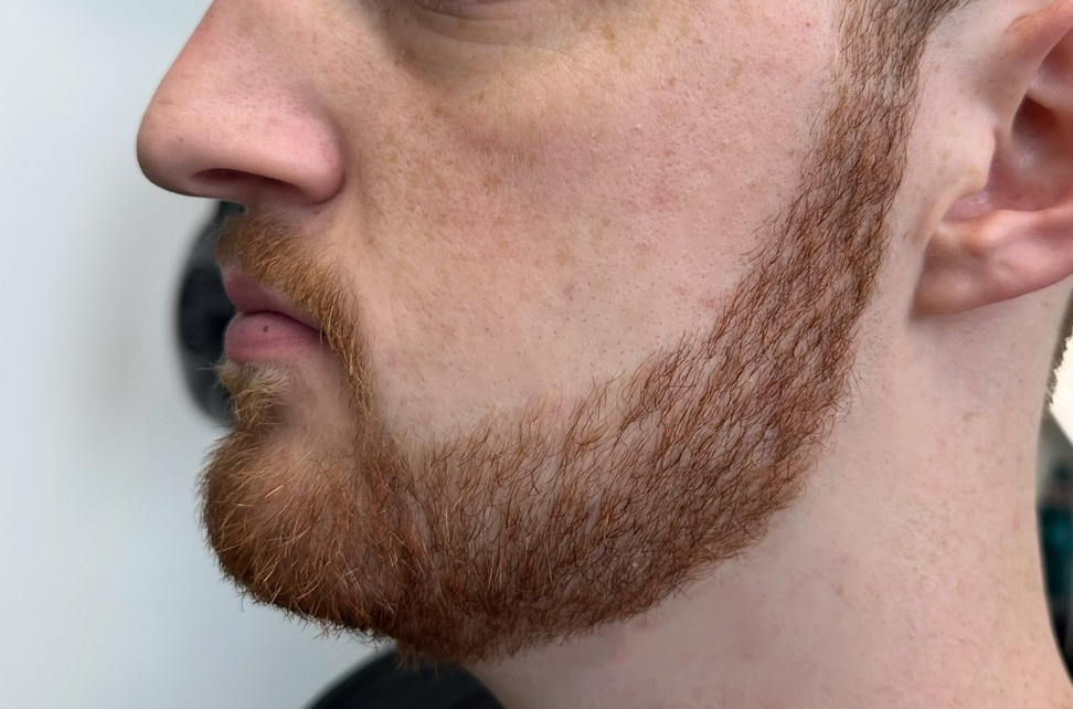 Beard Trim