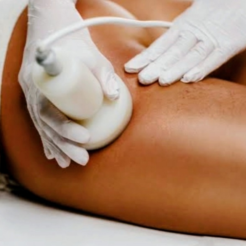 Cellulite & Skin Smoothing Therapy at Top Tier Massage & Wellness LLC in Abingdon, MD