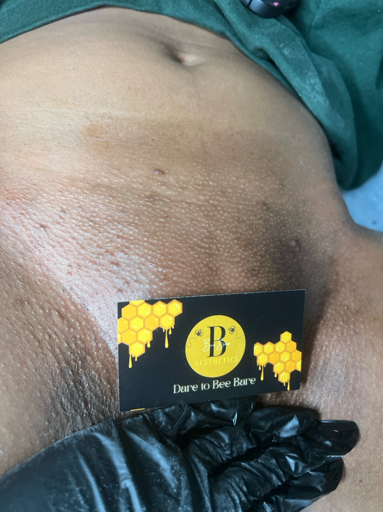 Brazillian + Stomach Strip