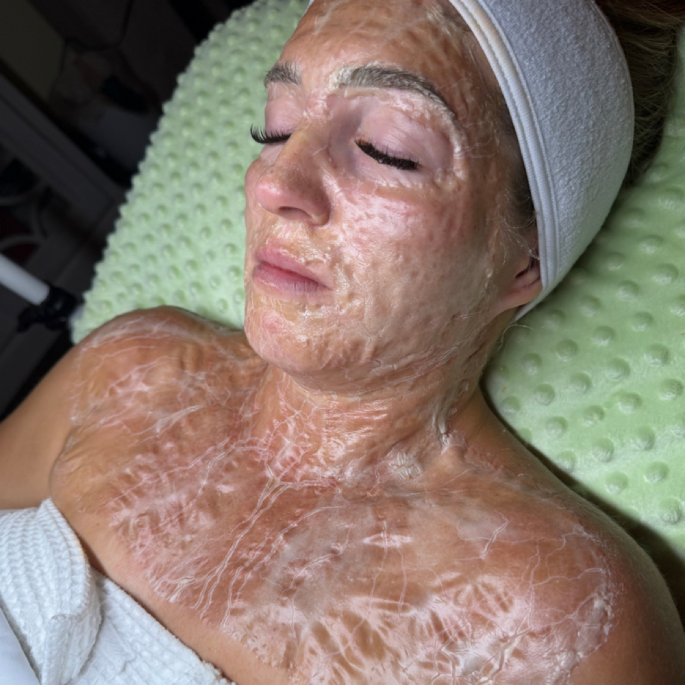 DMK Enzyme Therapy at Jade Esthetics in Oviedo, FL