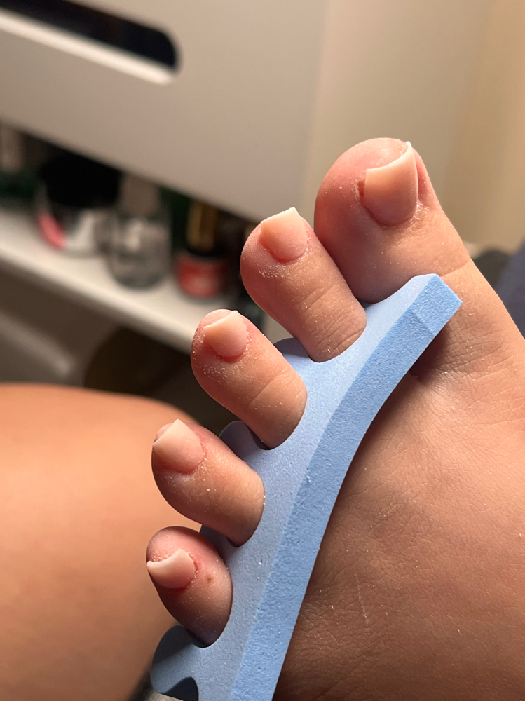 Acylic On Toes at Aloco. in Fort Myers, FL