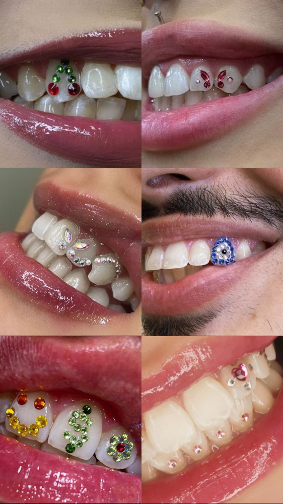 Freestyle Tooth Gems✨💎