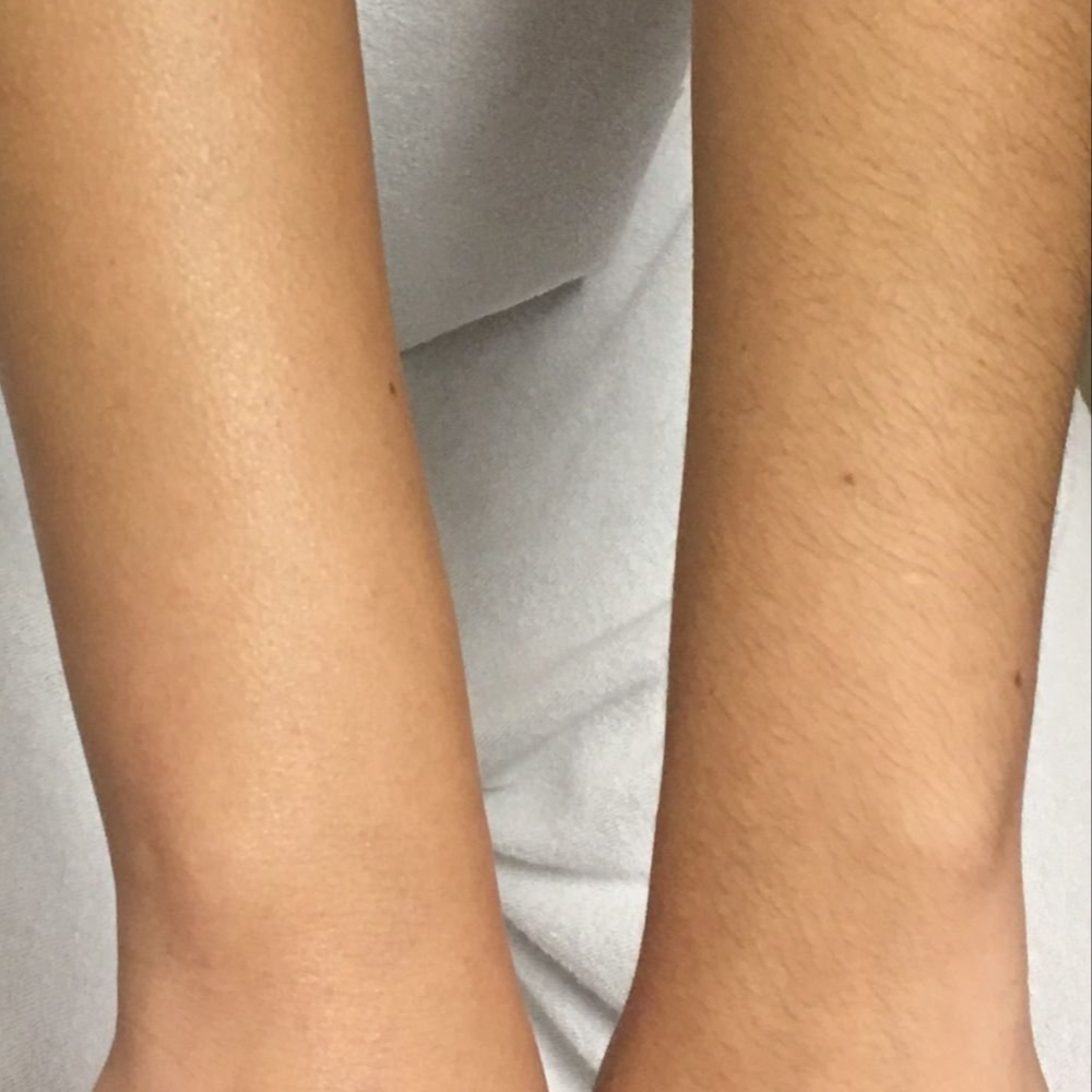 Half Arms at LuxBareBits in Wantagh, NY