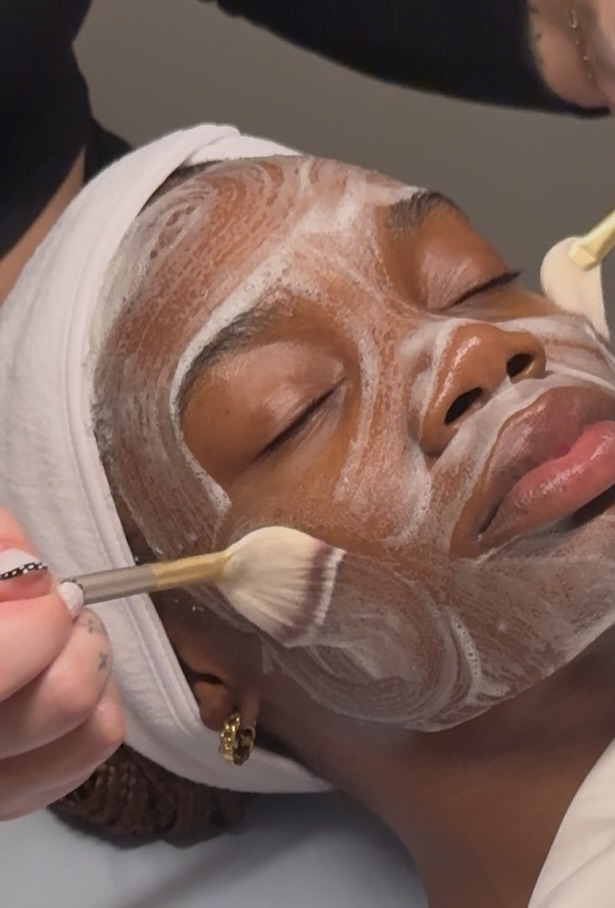 Acne Rescue Oxygen RX Facial