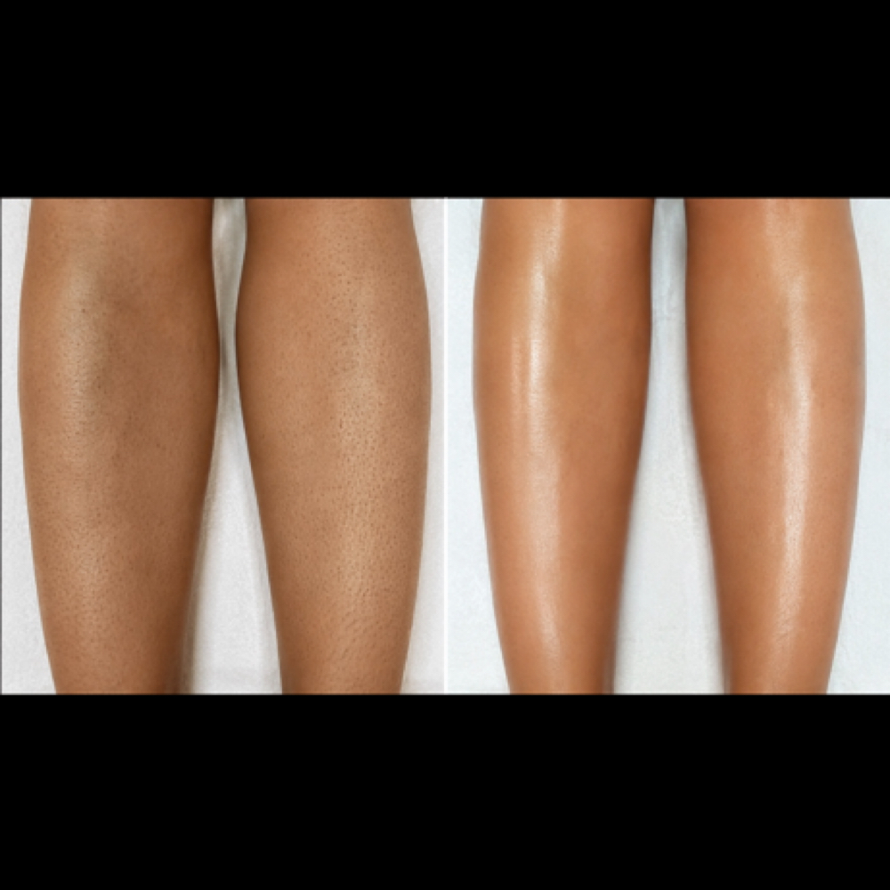 Legs Polish Treatment at Dreams Spa in hesperia, CA