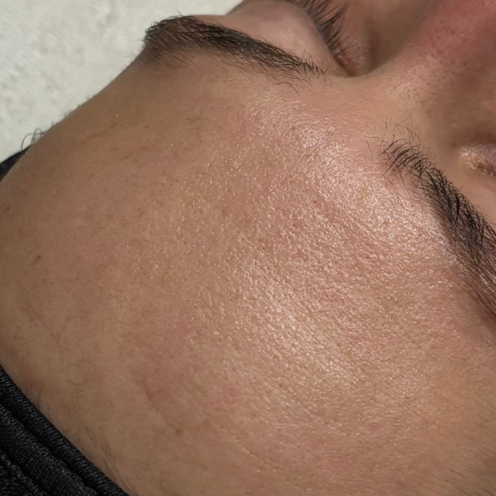 Customized Facial at Windhorse Esthetics in Loveland, CO