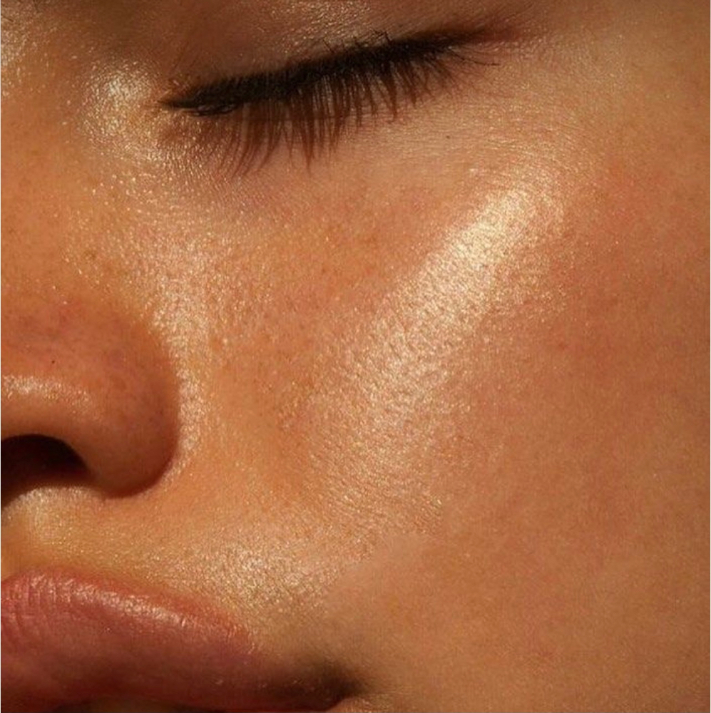 RF Skin Tightening Facial