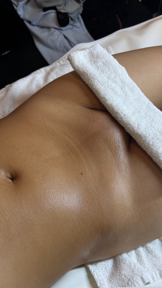 Full Stomach at Complexion LA in Los Angeles, CA