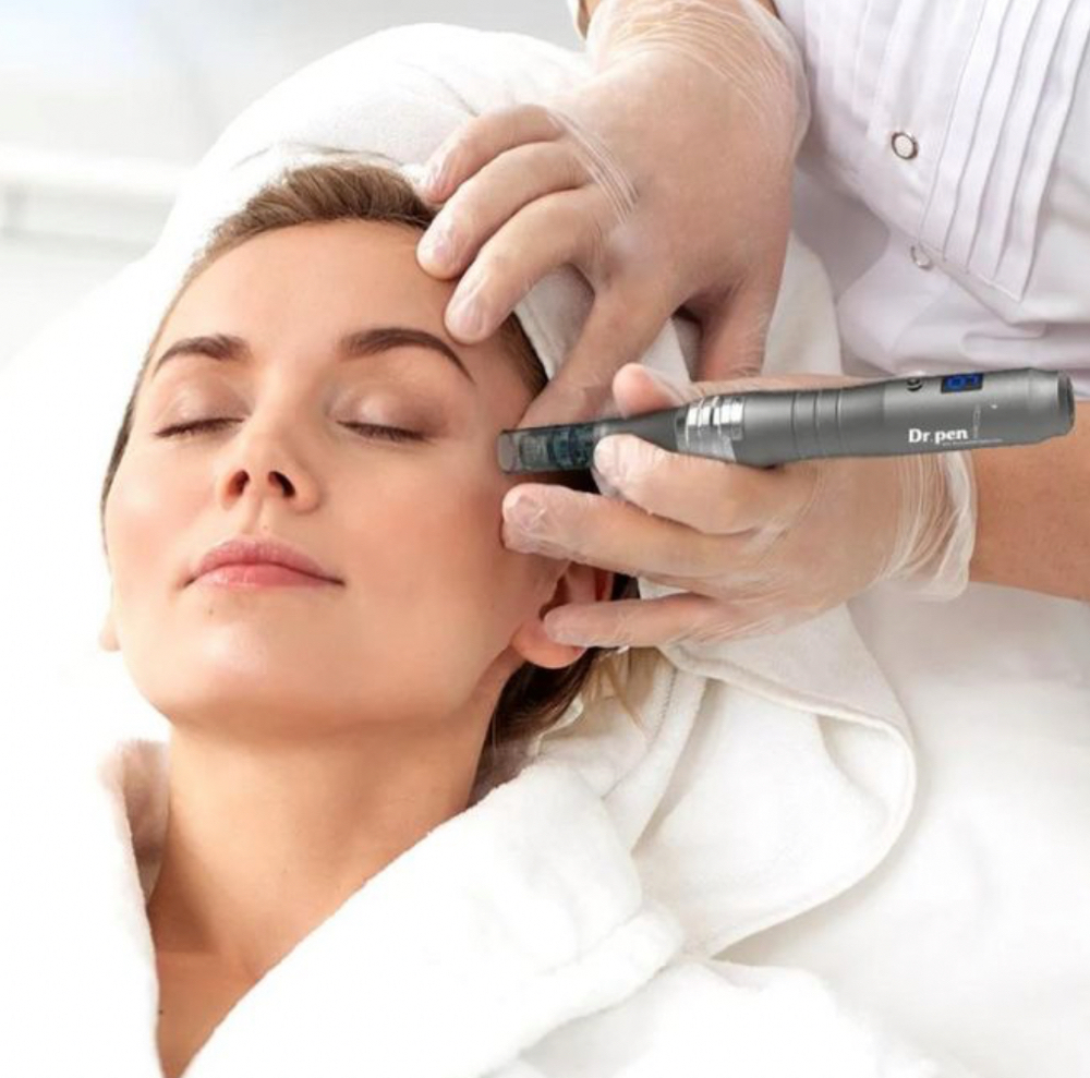 Microneedling (face) + RF