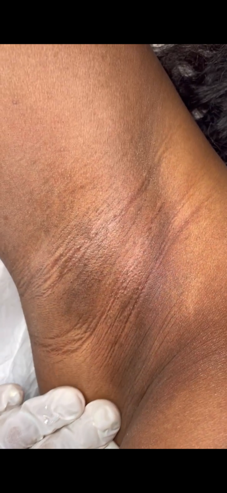 Underarm Wax