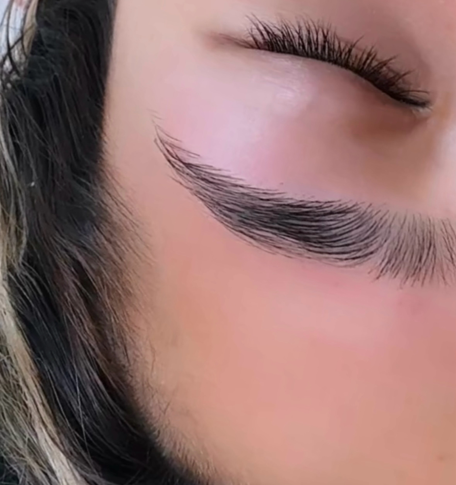 Hair Removal Options