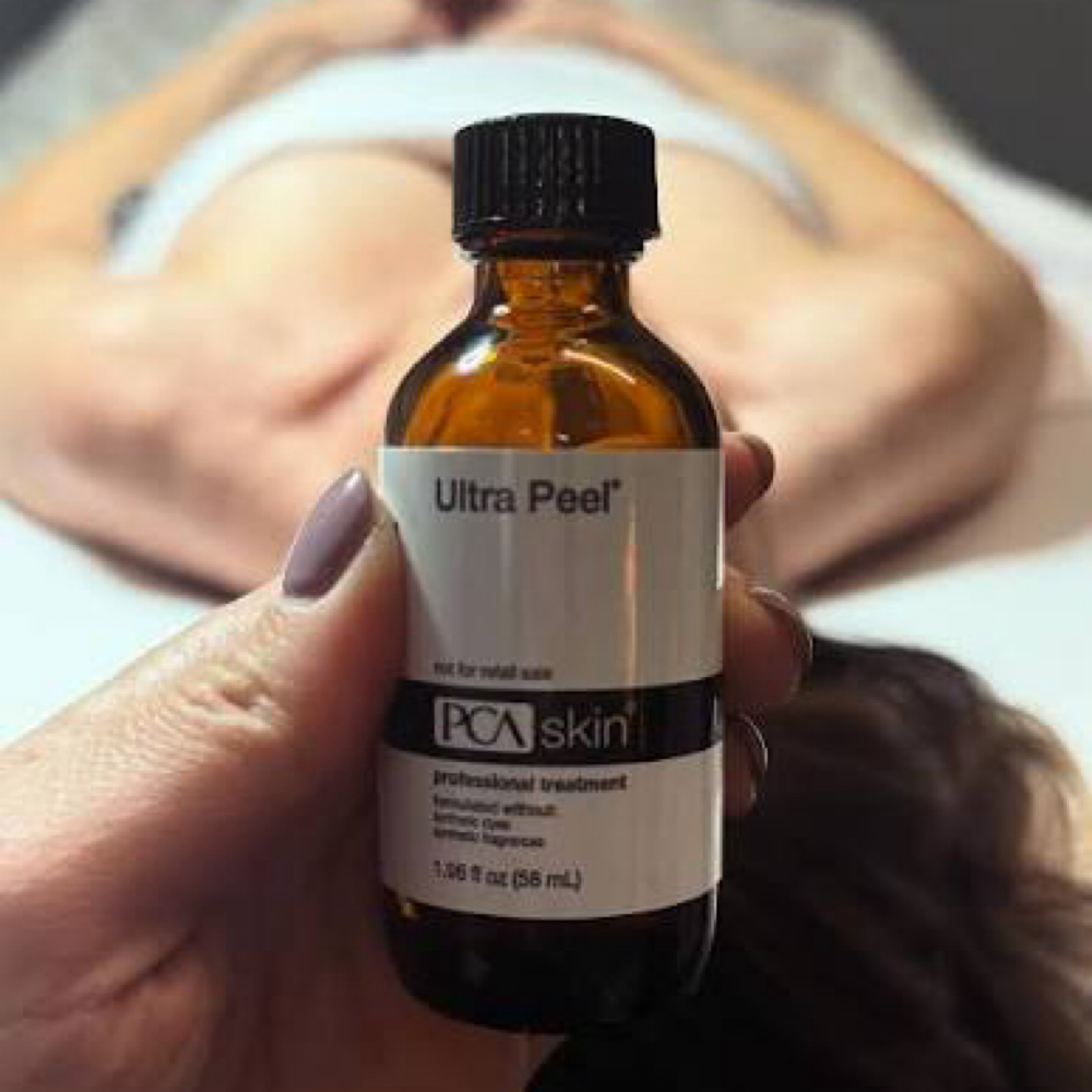 Ultra peel ( Anti-Aging Option) at I Do Lashes in Frisco, TX