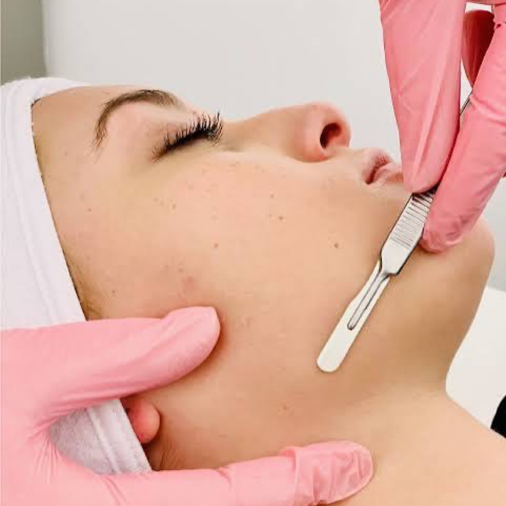 (Add on) Dermaplane at SkinUpgradeMD in Charlotte, NC