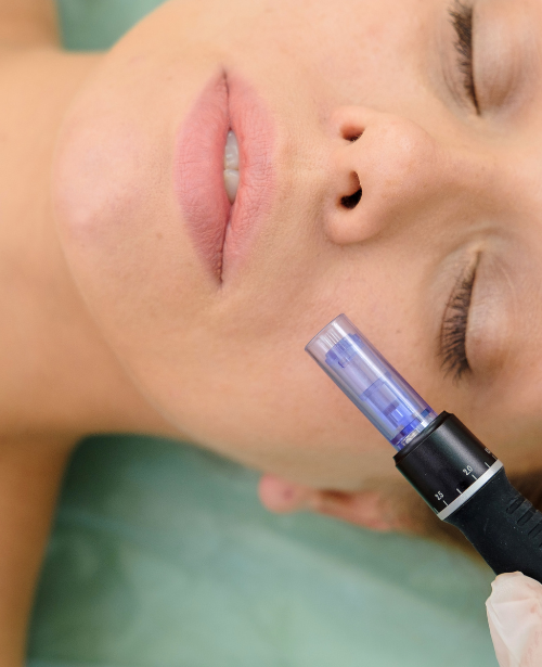 Nano-infusion