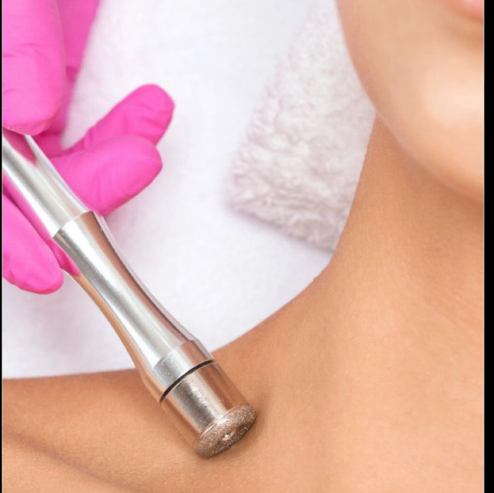 Added Area Microderm Treatment at Skinsational Beauty Boutique in Bethany, OK
